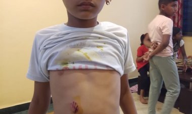 पाचगावात भटक्या कुत्र्यांचा सुळसुळाट : ग्रामपंचायतीत कुत्री सोडण्याचा  शिवसेनेचा ईशारा