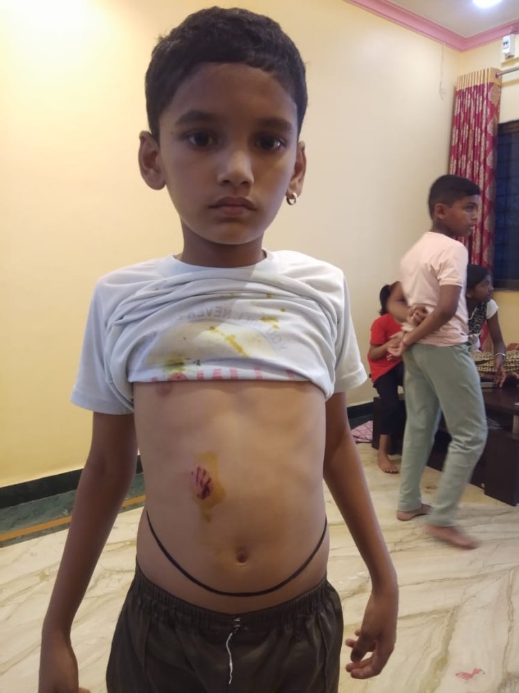 पाचगावात भटक्या कुत्र्यांचा सुळसुळाट : ग्रामपंचायतीत कुत्री सोडण्याचा शिवसेनेचा ईशारा