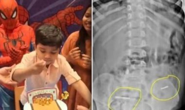 वाढदिवसाचा थीम केक बेतला जीवावर! 3 वर्षीय चिमुकल्याच्या पोटात गेल्या धातूच्या तारा